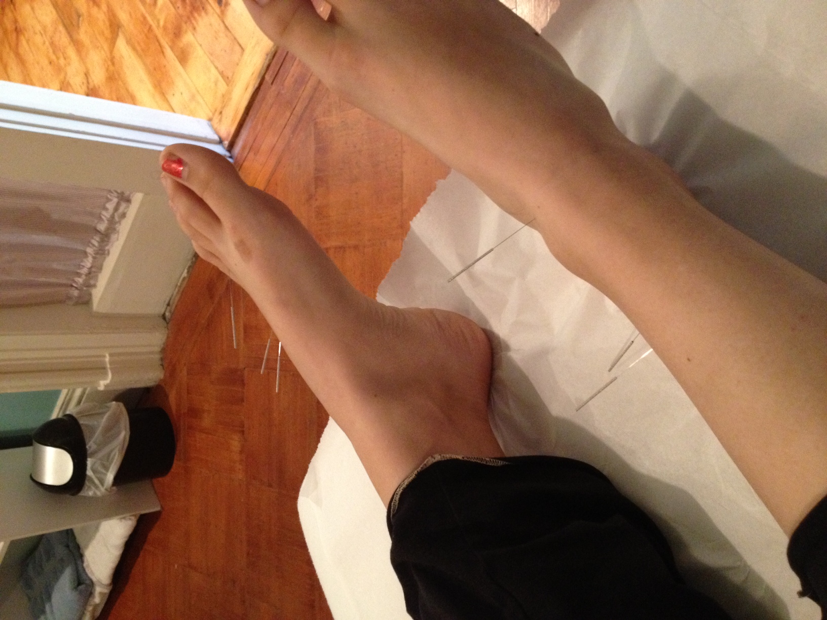 Feet acupuncture